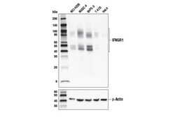 Cell Signaling Technology&nbsp;IFNGR1 E444 Antibody 100 ul