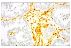 Cell Signaling Technology&nbsp;SignalStain R  Radiant Yellow