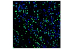 Cell Signaling Technology&nbsp;TUNEL Assay Kit  Fluorescence
