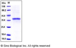 Sino Biological Recombinant Mouse ACP5 Protein (His Tag), Quantity: Each