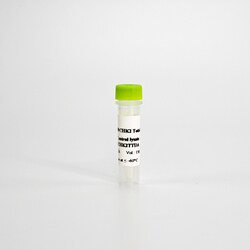 Revvity Health Sciences Inc HTRF Human Phospho-CHK-2 (Thr68) Detection Kit, Control Lysate