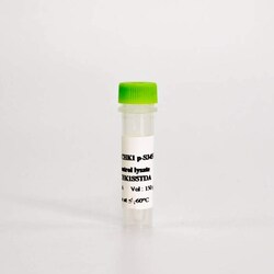 Revvity Health Sciences Inc&nbsp;HTRF Human & Mouse Phospho-CHK-1 (Ser345) Detection Kit, Control Lysate