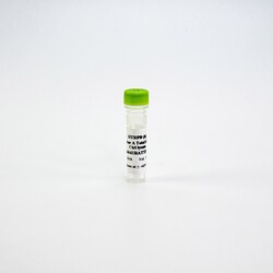 Revvity Health Sciences Inc&nbsp;HTRF Human Total Aurora A Detection Kit, Control Lysate