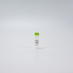 Revvity Health Sciences Inc&nbsp;HTRF Human & Mouse Phospho-Cofilin (Ser3) Detection Kit, Control Lysate