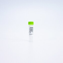 Revvity Health Sciences Inc&nbsp;HTRF Human & Mouse Total ATG16L1 Detection Kit, Control Lysate