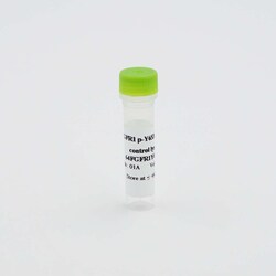 Revvity Health Sciences Inc&nbsp;HTRF Human Phospho-FGFR1 (Tyr653/654) Detection Kit, Control Lysate