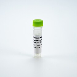 Revvity Health Sciences Inc&nbsp;HTRF Human Androgen Receptor Variant 7, Control Lysate