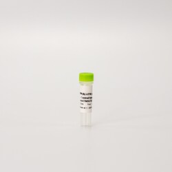 Revvity Health Sciences Inc&nbsp;HTRF Human Phospho-ATM (Ser1981) Detection Kit, Control Lysate