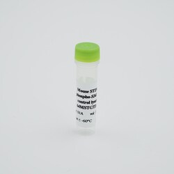 Revvity Health Sciences Inc&nbsp;HTRF Mouse Phospho-STING (Ser365) Detection Kit, Control Lysate