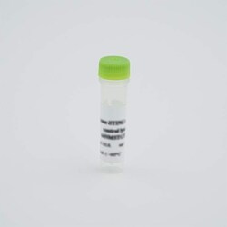 Revvity Health Sciences Inc&nbsp;HTRF Human & Mouse TOM20 Detection Kit Standard