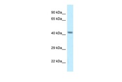 Aviva Systems Biology Corp Cacng8 Antibody - middle region (ARP35367_P050)