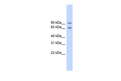 Aviva Systems Biology Corp CACNB2 Antibody - middle region (ARP35602_P050)