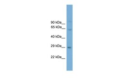 Aviva Systems Biology Corp Prrx2 Antibody - N-terminal region (ARP36973_P050)