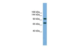Aviva Systems Biology Corp Ttf1 Antibody - N-terminal region (ARP36997_P050)
