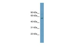 Aviva Systems Biology Corp Rorc Antibody - N-terminal region (ARP37127_P050)