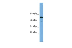 Aviva Systems Biology Corp Onecut3 Antibody - C-terminal region (ARP37481_P050)