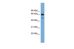 Aviva Systems Biology Corp Ebf4 Antibody - middle region (ARP37501_P050)
