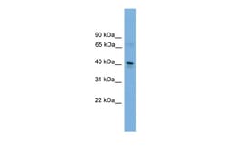 Aviva Systems Biology Corp Tfdp2 Antibody - C-terminal region (ARP37585_P050)