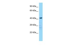 Aviva Systems Biology Corp Ldb2 Antibody - N-terminal region (ARP38020_P050)