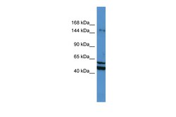 Aviva Systems Biology Corp ZMYM3 Antibody - N-terminal region (ARP38562_P050)