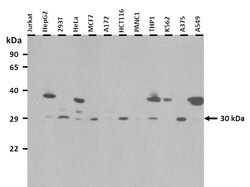 Aviva Systems Biology Corp LBX1 Antibody - N-terminal region (ARP38817_P050)