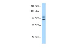 Aviva Systems Biology Corp ZHX1 Antibody - N-terminal region (ARP38924_P050)