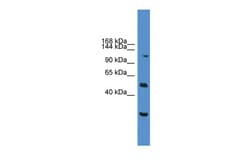 Aviva Systems Biology Corp NFATC2 Antibody - C-terminal region (ARP38988_P050)