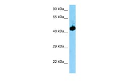 Aviva Systems Biology Corp Evl Antibody - middle region (ARP40846_P050)