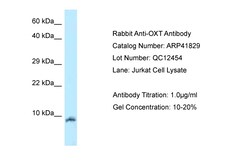 Aviva Systems Biology Corp OXT Antibody - N-terminal region (ARP41829_P050)