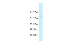Aviva Systems Biology Corp Arpp21 Antibody - N-terminal region (ARP41874_P050)