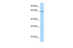 Aviva Systems Biology Corp Ubox5 Antibody - middle region (ARP43174_P050)