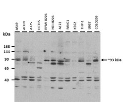 Aviva Systems Biology Corp SLC9A3 Antibody - middle region (ARP43870_P050)