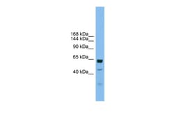 Aviva Systems Biology Corp UMODL1 Antibody - middle region (ARP44475_P050)