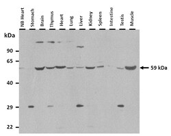 Aviva Systems Biology Corp Dct Antibody - middle region (ARP45193_P050)