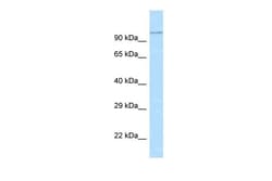 Aviva Systems Biology Corp Adam29 Antibody - N-terminal region (ARP46991_P050)