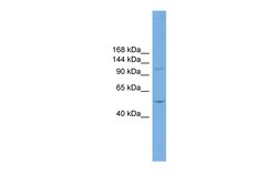 Aviva Systems Biology Corp TNNI3K Antibody - N-terminal region (ARP48044_P050)