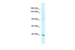 Aviva Systems Biology Corp PCDHA11 Antibody - N-terminal region (ARP49346_P050)