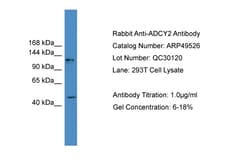 Aviva Systems Biology Corp ADCY2 Antibody - middle region (ARP49526_P050)