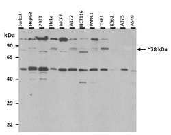 Aviva Systems Biology Corp MED25 Antibody - N-terminal region (ARP50698_P050)