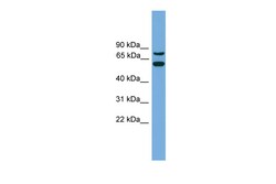 Aviva Systems Biology Corp YY1AP1 Antibody - middle region (ARP50779_P050)