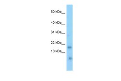 Aviva Systems Biology Corp Tnfrsf12a Antibody - N-terminal region (ARP51328_P050)