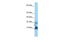Aviva Systems Biology Corp CGA Antibody - N-terminal region (ARP51770_P050)