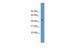 Aviva Systems Biology Corp FAM53A Antibody - C-terminal region (ARP51825_P050)
