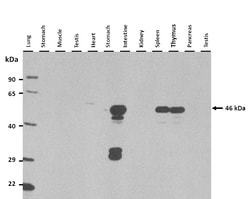 Aviva Systems Biology Corp Dusp7 Antibody - middle region (ARP52002_P050)