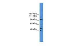 Aviva Systems Biology Corp PIBF1 Antibody - C-terminal region (ARP52152_P050)