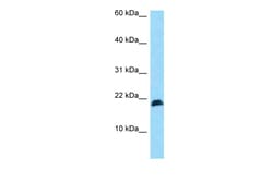 Aviva Systems Biology Corp HBXIP Antibody - N-terminal region (ARP52178_P050)