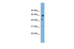 Aviva Systems Biology Corp PNKP Antibody - N-terminal region (ARP52311_P050)