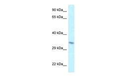 Aviva Systems Biology Corp Taf8 Antibody - middle region (ARP52628_P050)