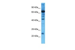 Aviva Systems Biology Corp CHMP4B Antibody - middle region (ARP53339_P050)