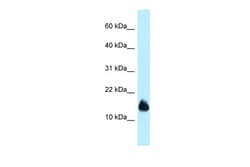 Aviva Systems Biology Corp 1110059E24Rik Antibody - N-terminal region (ARP53424_P050)